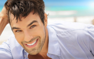 veneers