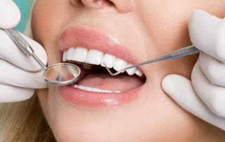 Three Varieties of Dental Cleanings