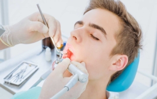 Signs that you might need a root canal